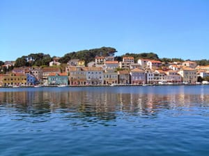 Hrvatska otvara vrata zdravlju: Otkrijte tajne zdravstvenog turizma koje nećeš moći odbiti!